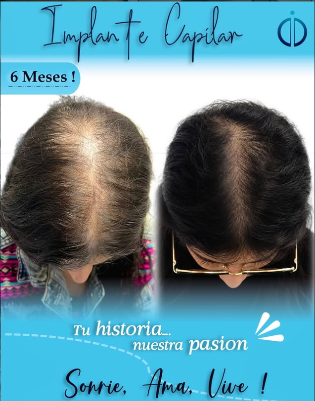 Promoción 3