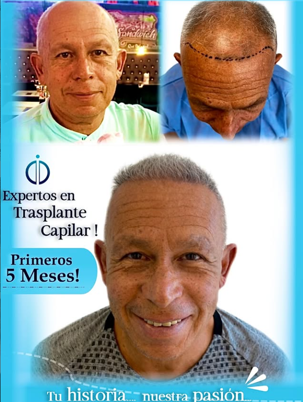 Promoción 6